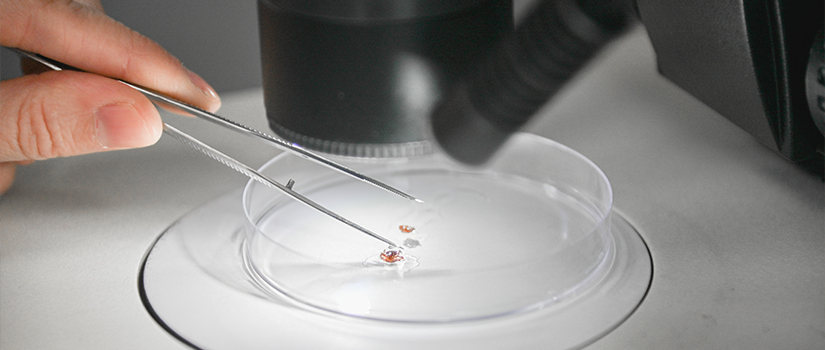 Close up of hand placing a tick under a microscope