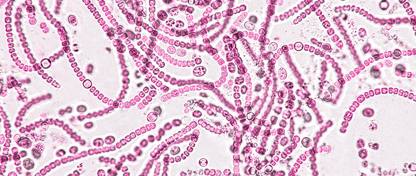 A photo of reddish microscopic probiotic cells on a bright white background.