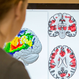 Researcher looking at brain imaging scans on a monitor, highlighting advanced neurological research and diagnostic technology.