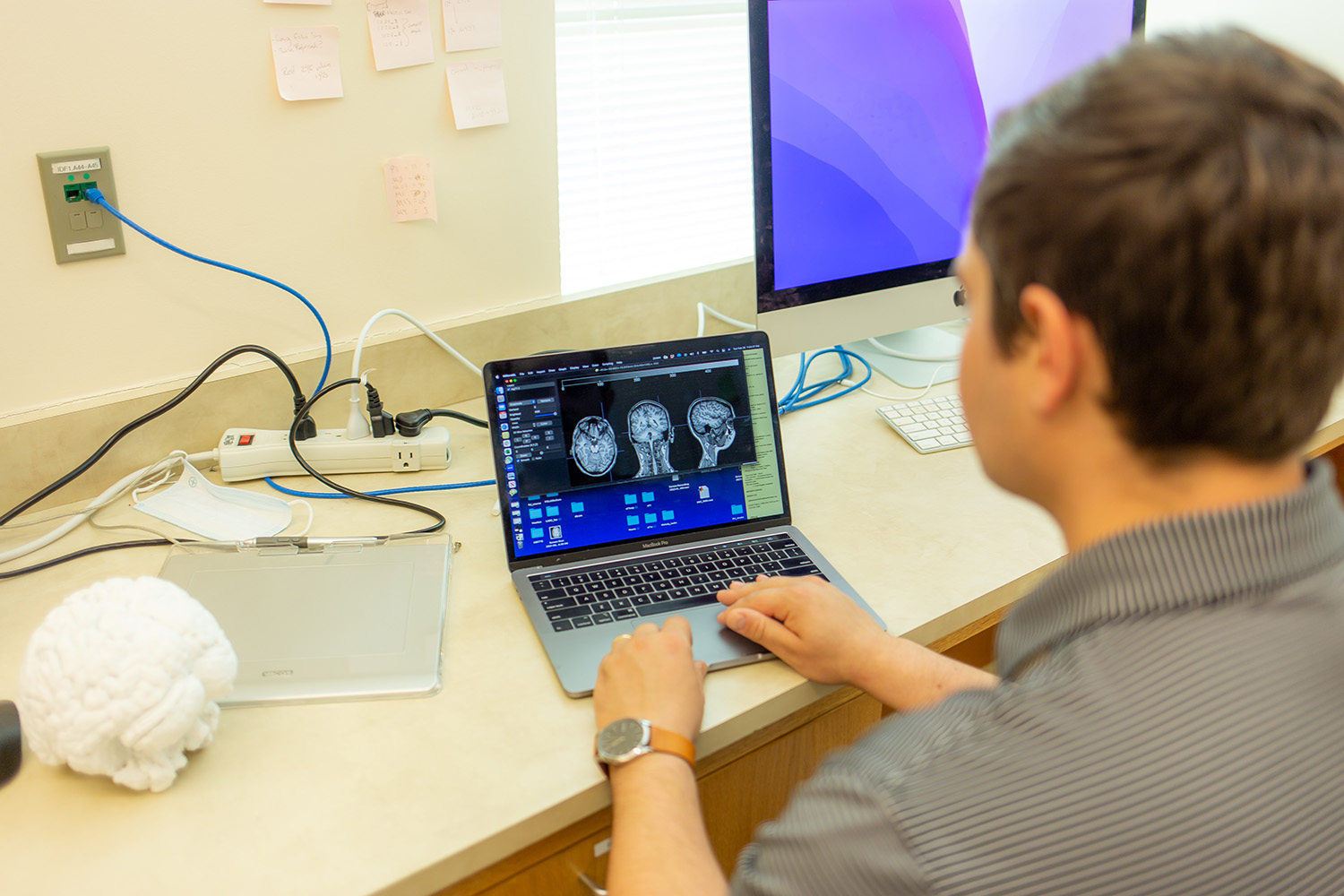 Nicholas Riccardi looks at brain scans on a computer screen.