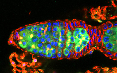 Picture of a Drosophila germarium
