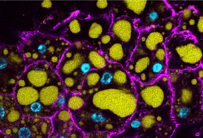 Image of adipocytes in the female fly