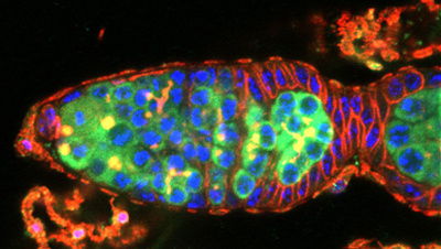 Picture of a Drosophila ovary