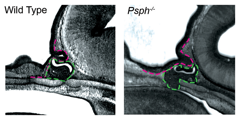 Image of the developing pituitary gland in normal and mutant embryos