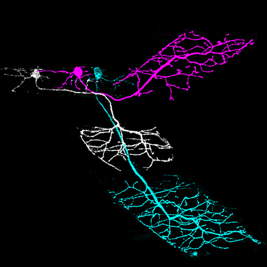 Motor Neurons Image