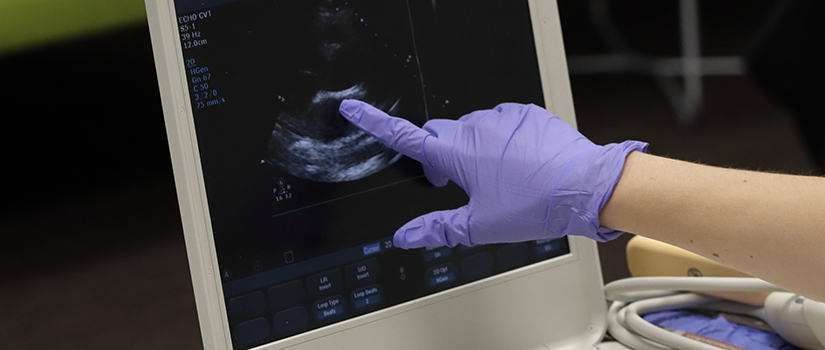 Purple glove pointing at a sonogram screen
