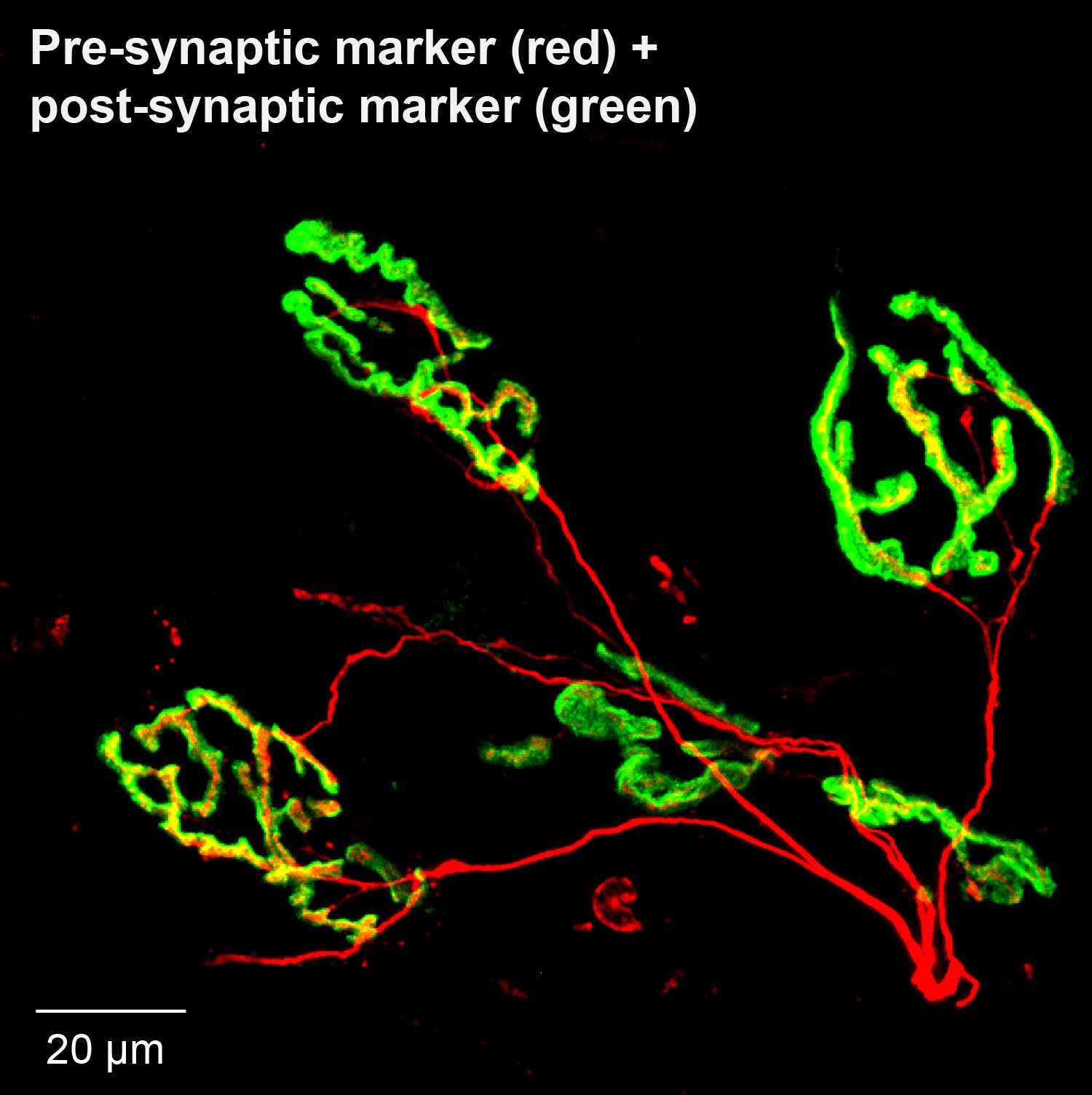 Microscopy image showing red pre-synaptic and green post-synaptic nerve markers, with areas of overlap appearing yellow.
