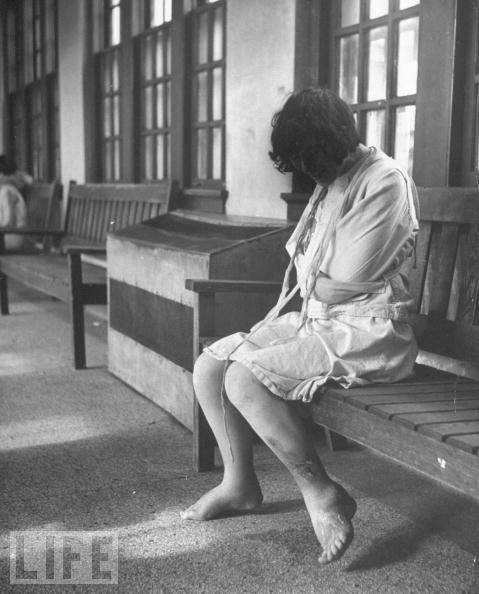 woman sitting alone  in a straight jacket restraint with dark hair blocking her face.