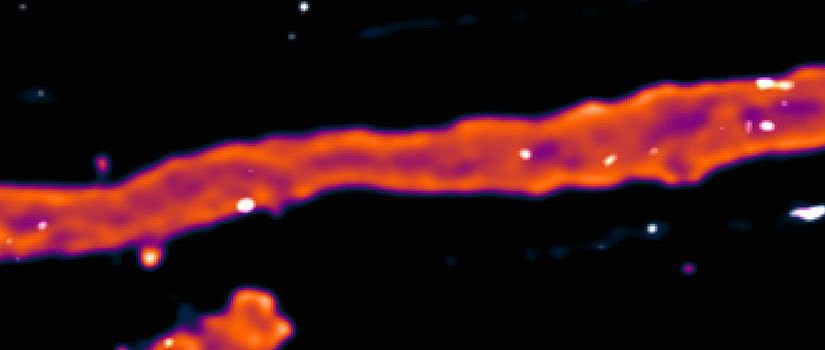 A flourescent image of nerve axons