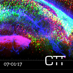 Michy Kelly X-Clarity