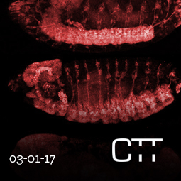 Xu Michy Alzheimer's