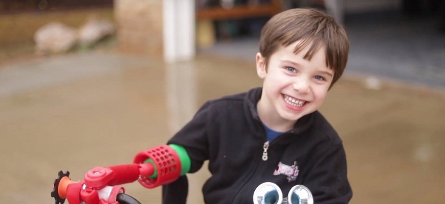 Happy recipient of a HOPE prosthetic hand