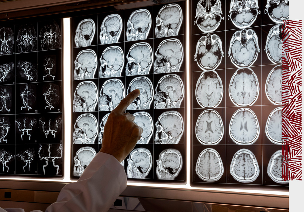 a person looks at brain scans on a computer