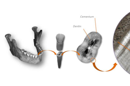 composite image shows bones and measurements