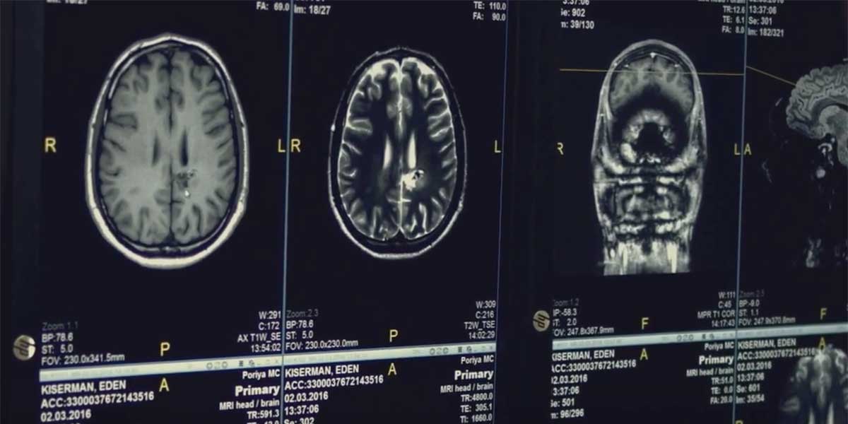 Expanding Access to Brain Health Care in South Carolina: USC’s New Clinic Brings Hope to Those Affected by Dementia and Related Disorders