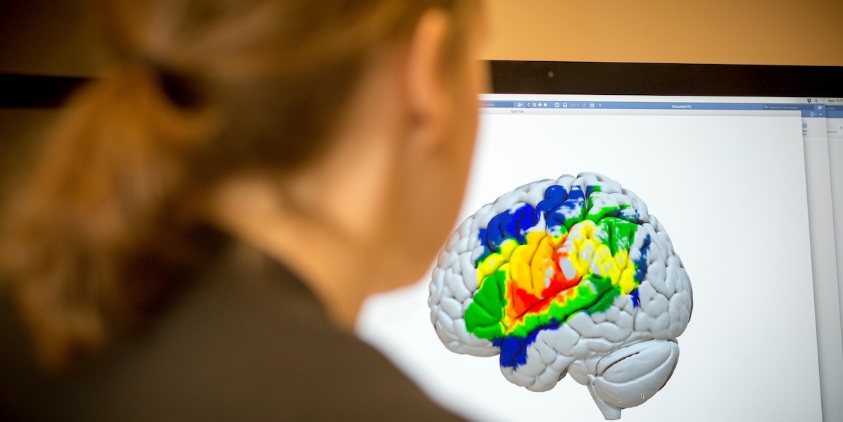Focusing on the brain – USC News & Events